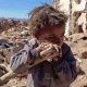 اليونيسيف: نصف مليون طفل باليمن يعانون من سوء التغذية الحاد الوخيم