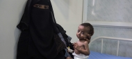 الأمم المتحدة تطلق نداء لجمع 2.8 مليار دولار للاحتياجات الإنسانية لليمن في 2024