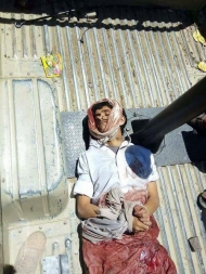 صورة القيادي الميداني للمليشيات ابو علي الذي قتل في جبهة الكدحة