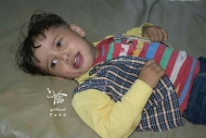 صورة لطفل أحد ضحايا قصف المليشيات الاحياء السكنية بتعز
