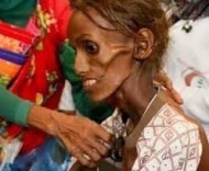 جذر المجاعة