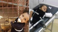 إب.. أسد يلتهم يد طفلة يمنية في حديقة الحيوان